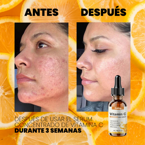 OFERTA 2X1 - SERUM CONCENTRADO de VITAMINA C. COLÁGENO y ÁCIDO HIALURÓNICO