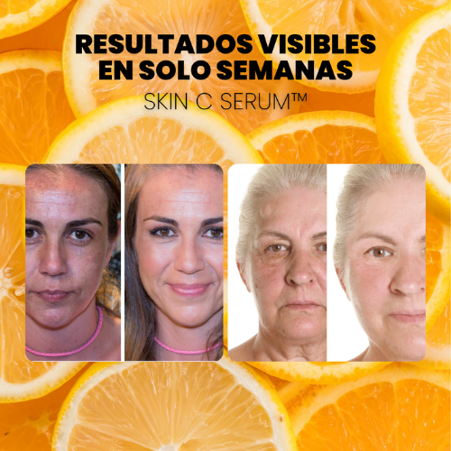 OFERTA 2X1 - SERUM CONCENTRADO de VITAMINA C. COLÁGENO y ÁCIDO HIALURÓNICO