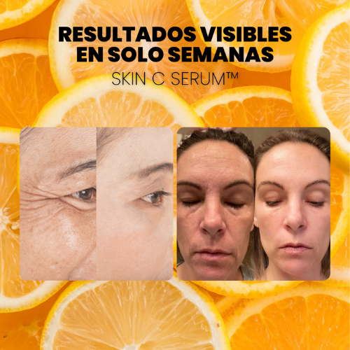 OFERTA 2X1 - SERUM CONCENTRADO de VITAMINA C. COLÁGENO y ÁCIDO HIALURÓNICO