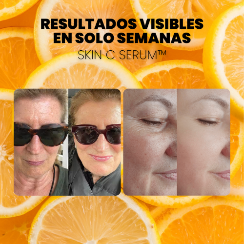 OFERTA 2X1 - SERUM CONCENTRADO de VITAMINA C. COLÁGENO y ÁCIDO HIALURÓNICO