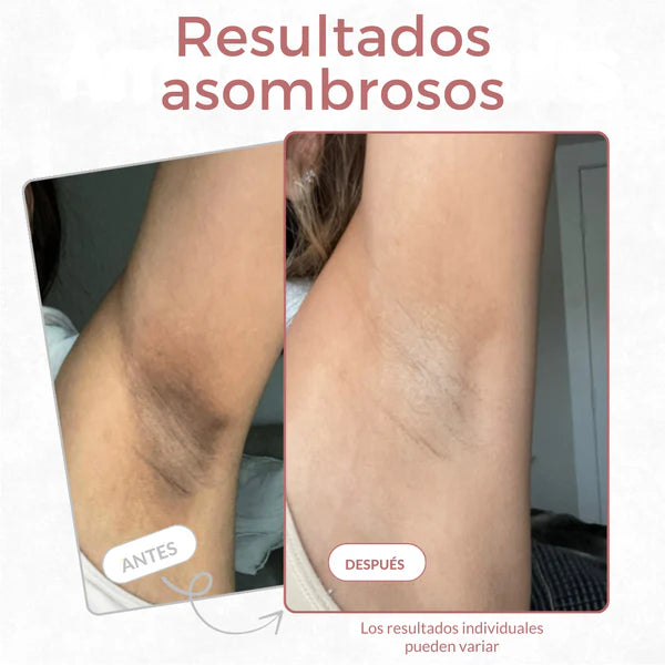 Spray Exfoliante Turmeric