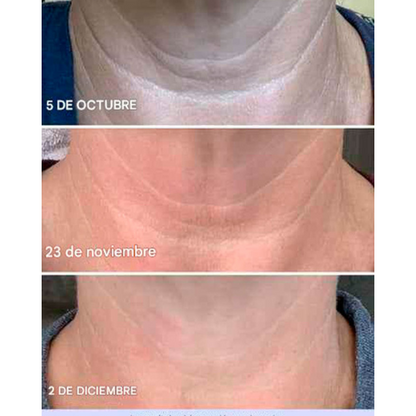 Crema Anti-Arrugas GoPure: Cuello Firme, Piel Joven