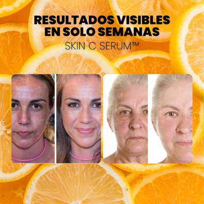 OFERTA 2X1 - SERUM CONCENTRADO de VITAMINA C. COLÁGENO y ÁCIDO HIALURÓNICO