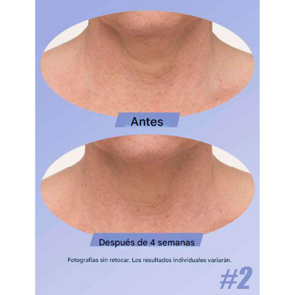 Crema Anti-Arrugas GoPure: Cuello Firme, Piel Joven