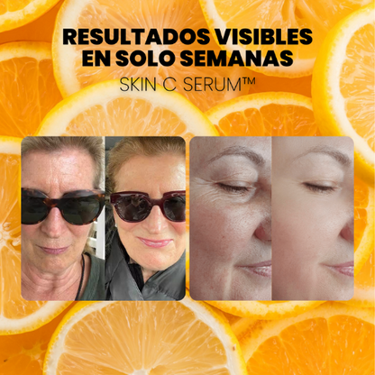 OFERTA 2X1 - SERUM CONCENTRADO de VITAMINA C. COLÁGENO y ÁCIDO HIALURÓNICO