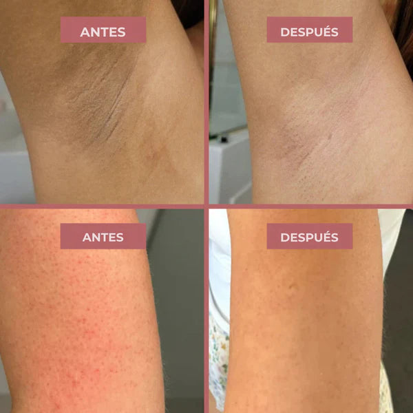 Spray Exfoliante Turmeric